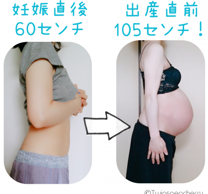 ６０センチのウエストが双子出産直前１０５センチに！妊娠腺にも気づけず、お腹ははちきれそうでした